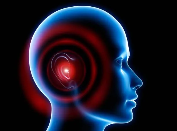 tinnitus masking in Sarnia ON